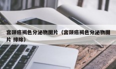 宫颈癌褐色分泌物图片（宫颈癌褐色分泌物图片 排除）