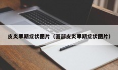 皮炎早期症状图片（面部皮炎早期症状图片）